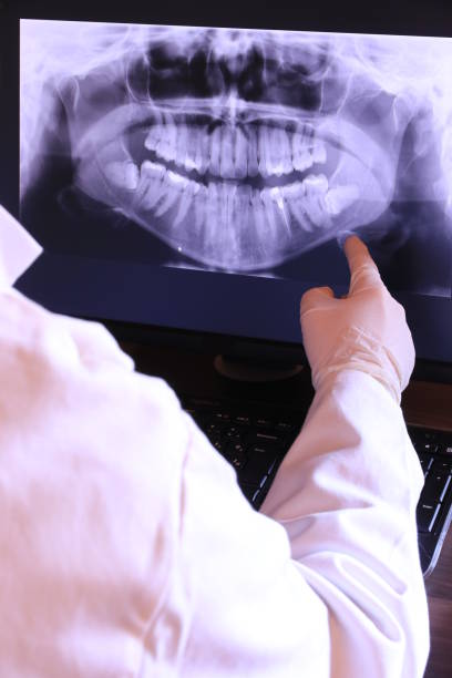 Best Emergency Wisdom Teeth Removal in Hebron, IL
